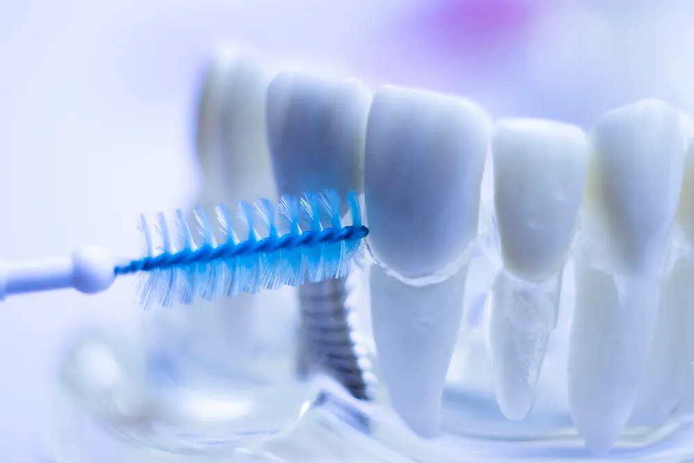 Beneficia Interdental perterget pro dentibus