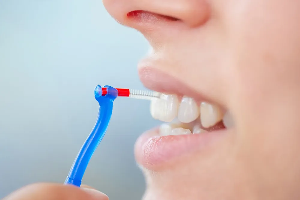 Recta via utere an Interdental Peniculus